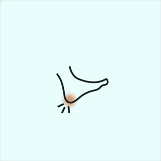 Heel Pain